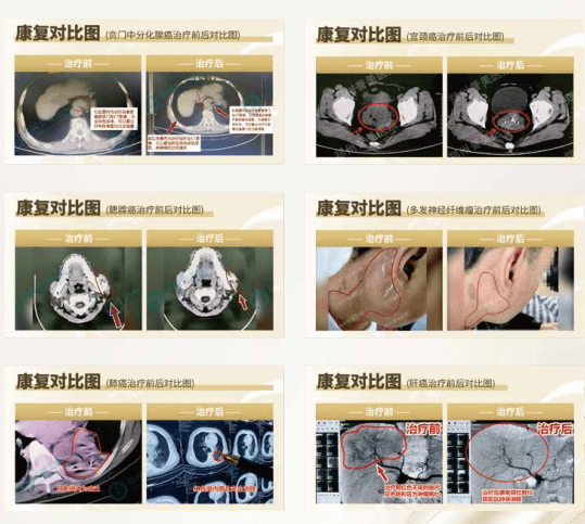 1781000398645182.png 360截图20251212151206 (NXPowerLite 副本).png